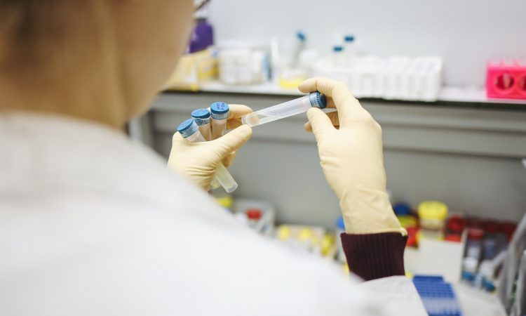 V ponedeljek potrdili 388 okužb z novim koronavirusom